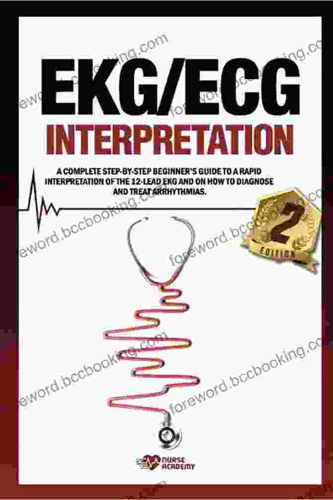 Identifying Common Arrhythmias EKG/ECG Interpretation: A Complete Step By Step Beginner S Guide To A Rapid Interpretation Of The 12 Lead EKG And On How To Diagnose And Treat Arrhythmias